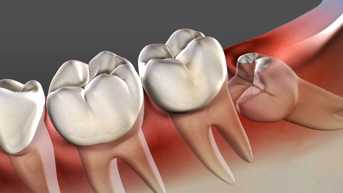 Revolutionize Your Oral Health with Bone Grafting Surgery