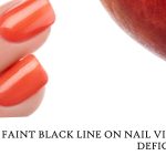 A Few Vital Recommendations to Relieve Back Discomfort 