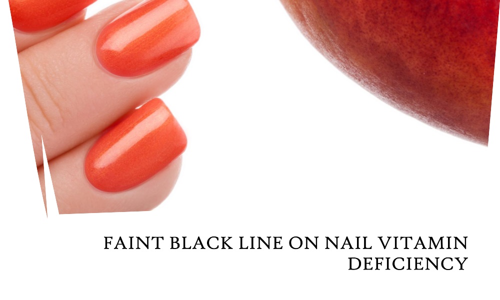 Faint Black Line on Nail and Vitamin Deficiency