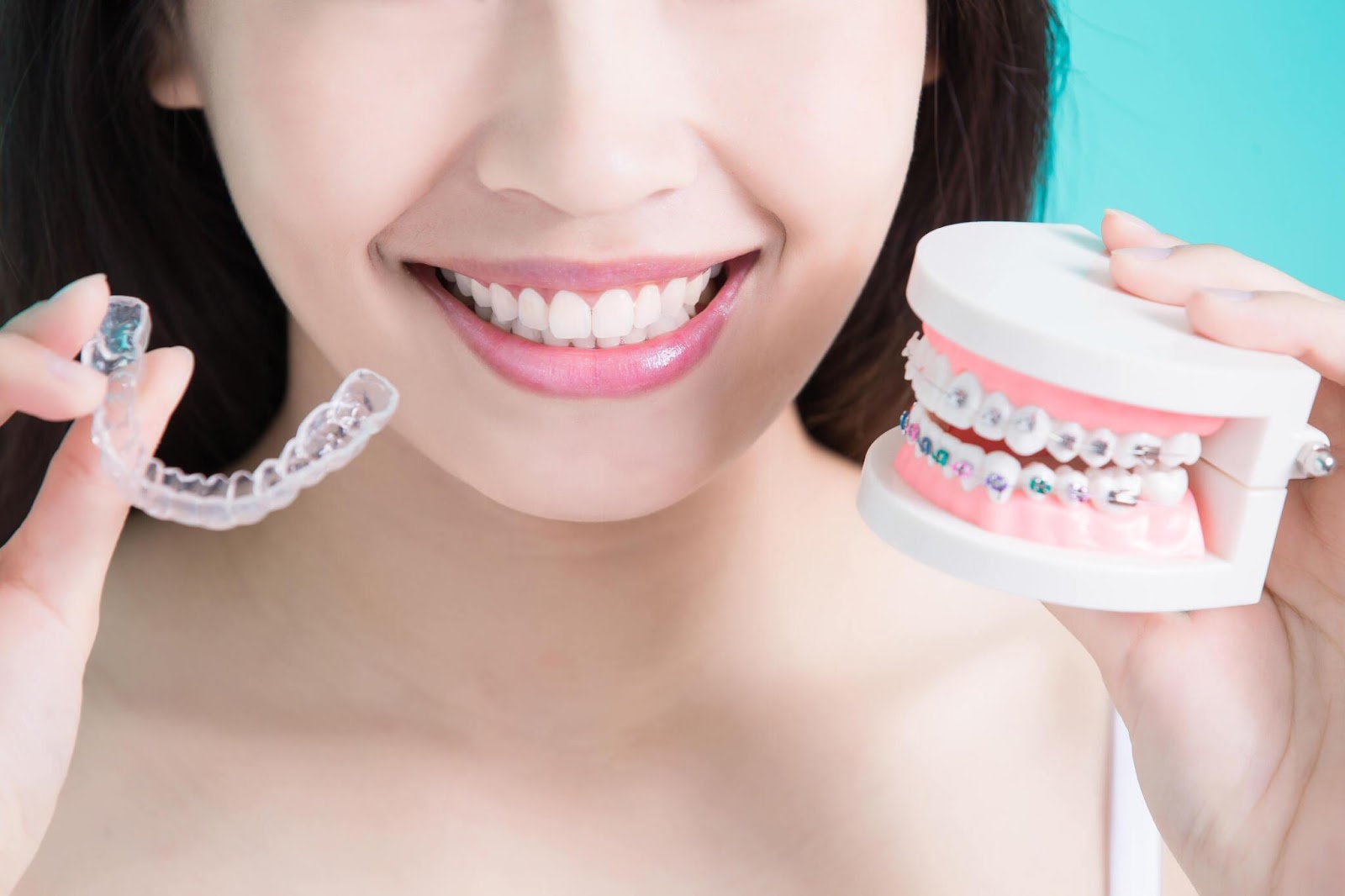 What Should You Do After Invisalign Treatment?