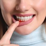 Advantages of Applying the CBG Oil to Improve Outcomes 