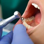 Linking Digestive and Oral Health in Green Valley, AZ