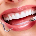 4 Signs You Need Restorative Dental Work Immediately