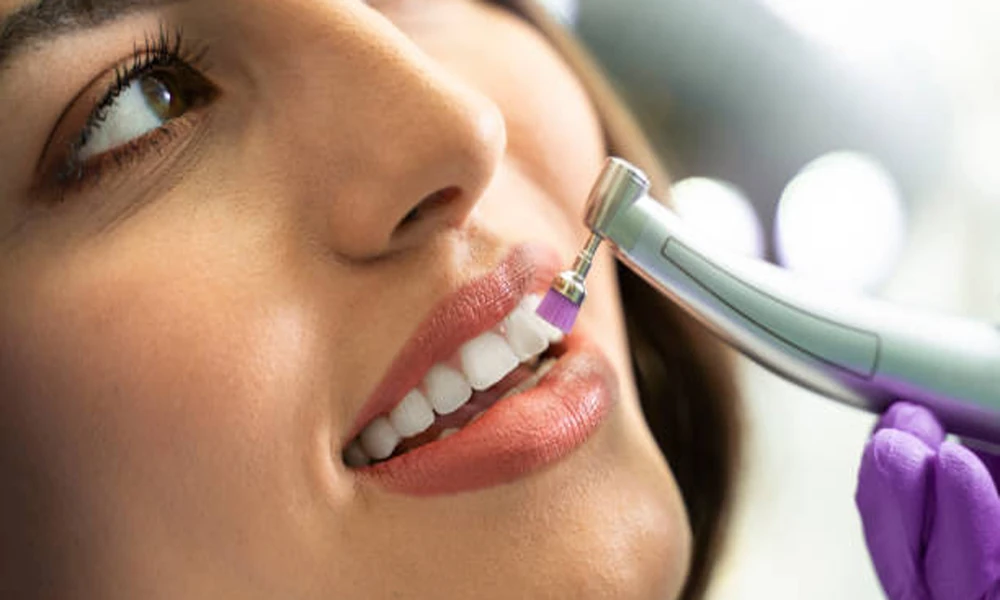 Cosmetic Care For Teeth With Mild Surface Irregularities