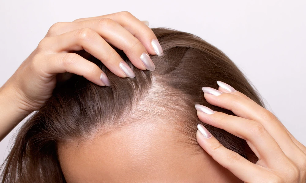 How Scalp Treatments Support Follicle Health And Healthier Hair Growth