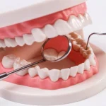 Why Antibiotics Do Not Replace Treatment For A Damaged Tooth