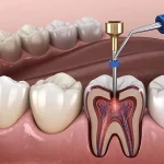 How Pediatric Dentists Monitor Teeth That Are Developing At An Unusual Angle